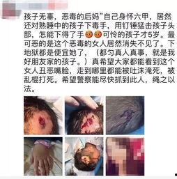 处理伤口视频,实用步骤与技巧解析