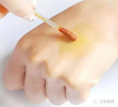处理伤口视频,实用步骤与技巧解析
