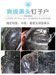 清除粉刺黑头粉刺视频,跟我学视频祛痘技巧