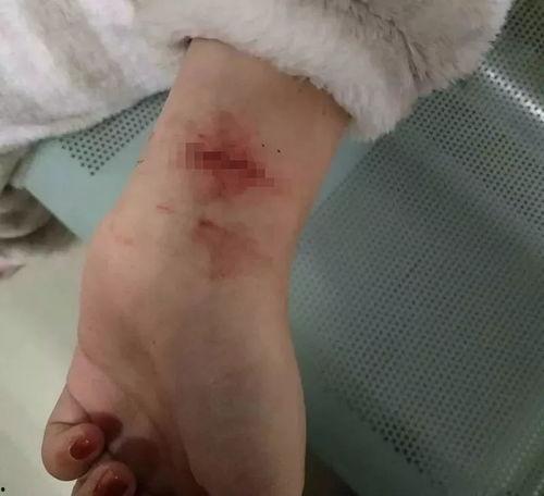 割手腕视频,揭秘网络暴力与心理健康危机