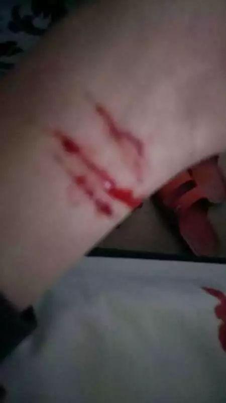 割手腕视频,揭秘网络暴力与心理健康危机