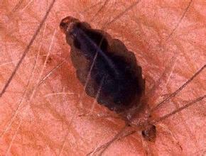 虱子视频,揭秘人类头虱与体虱的生存之道