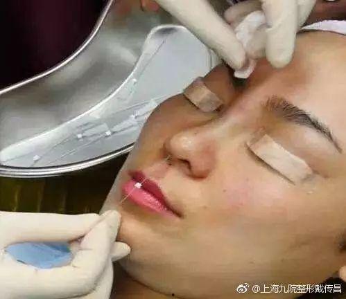 线雕鼻取线视频,轻松掌握美丽秘诀