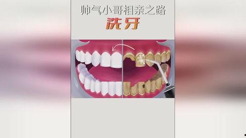 洗牙的视频,专业视频带你了解口腔清洁新体验